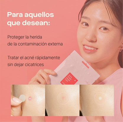 Acne Pimple Master Patch